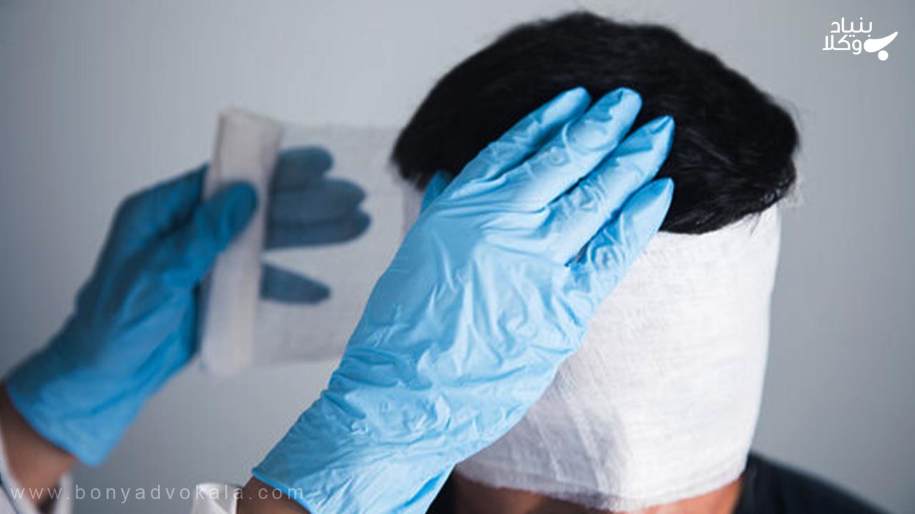 دیه شکستگی سر و انواع آن‌ها