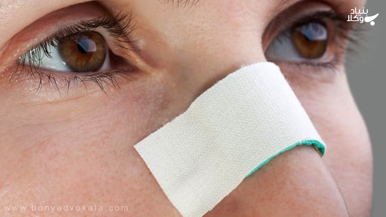 دیه شکستگی بینی در سال ۱۴۰۲ 2 انواع دیه شکستگی بینی