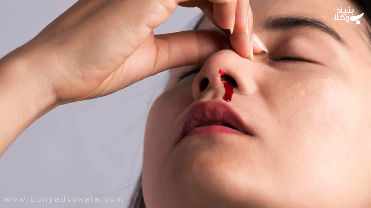 دیه شکستگی بینی در سال ۱۴۰۲ 3 شکستگی بینی