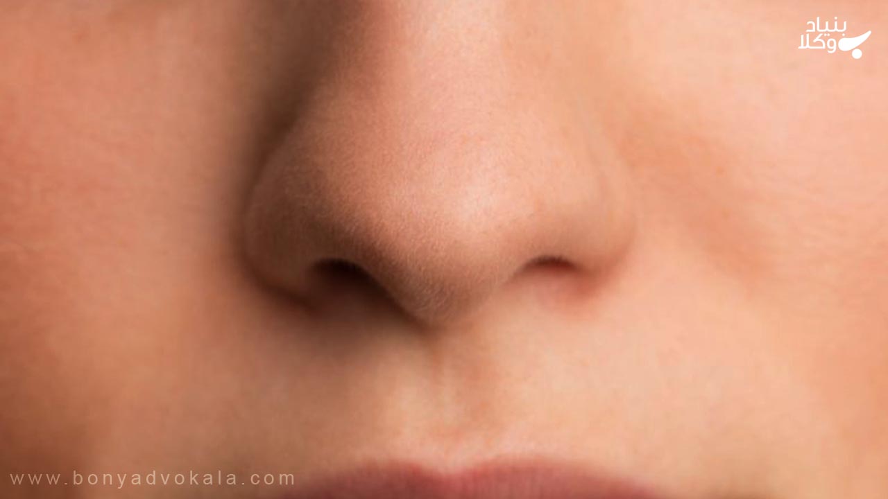 دیه شکستگی بینی در سال ۱۴۰۲ 5 اجرای قصاص بینی