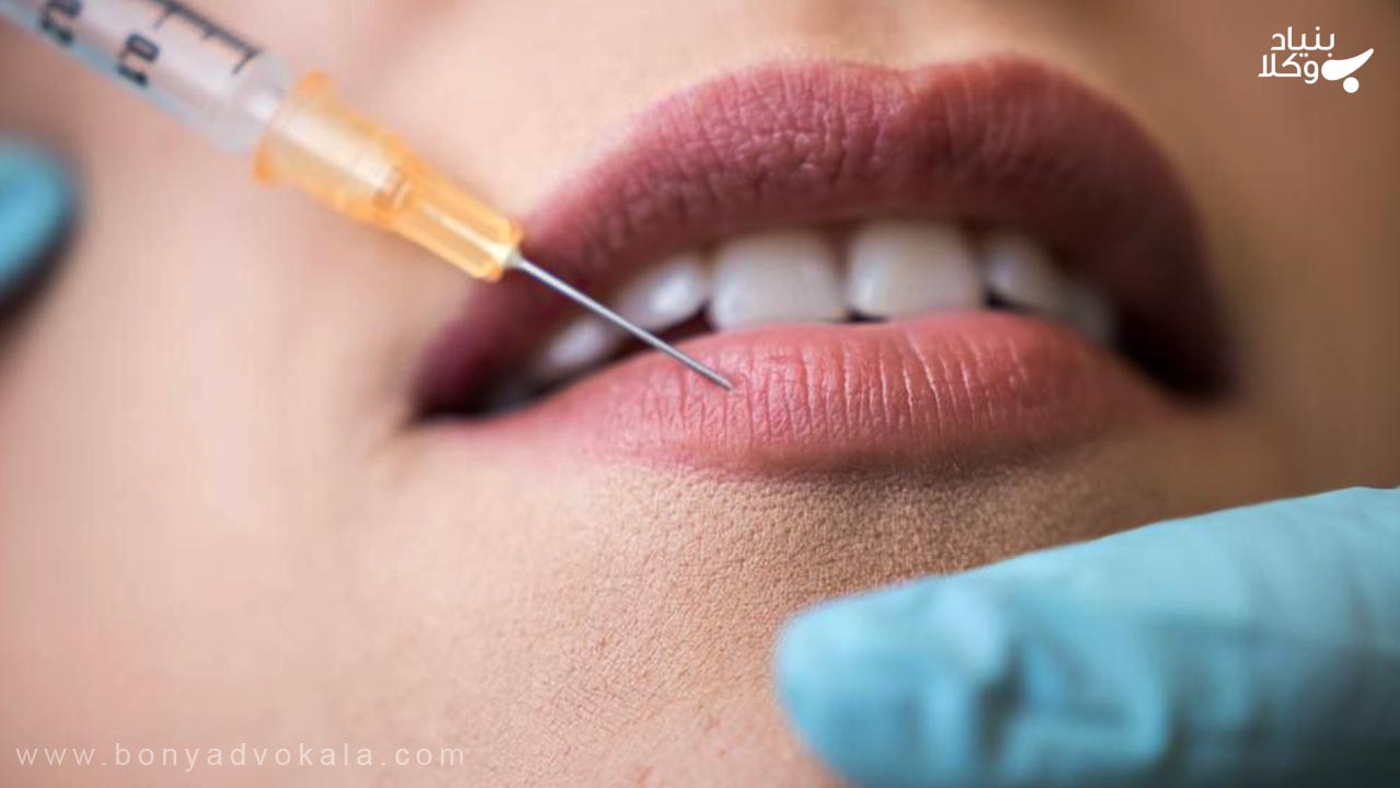 دیه از بین بردن و فلج شدن لب زن