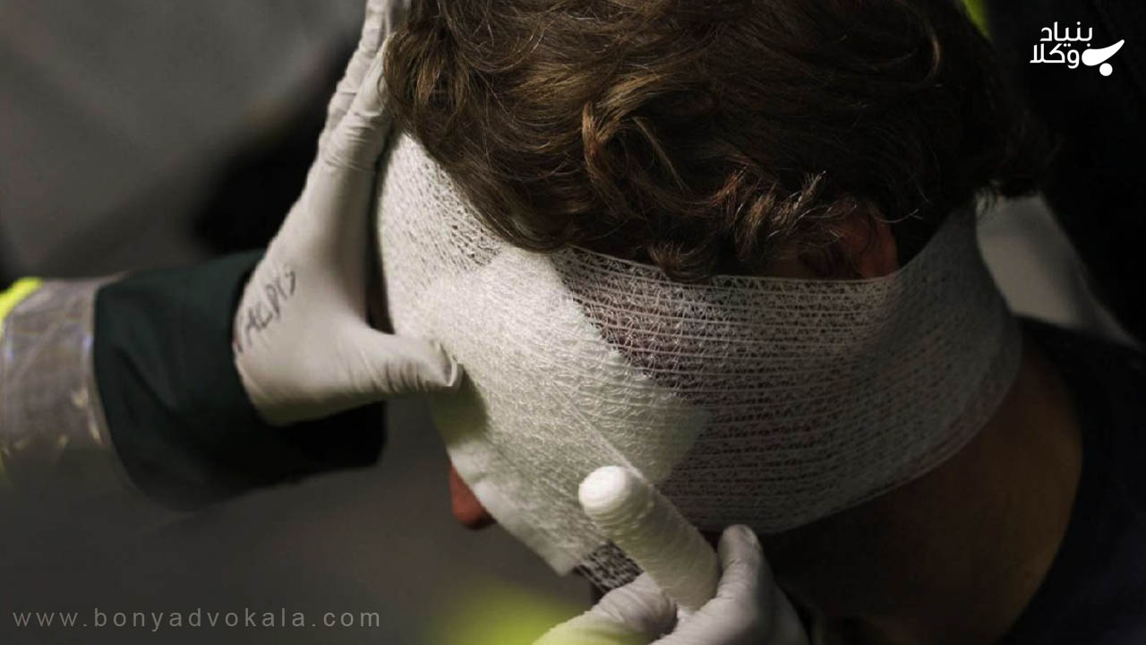 دیه بخیه جراحات سر و صورت