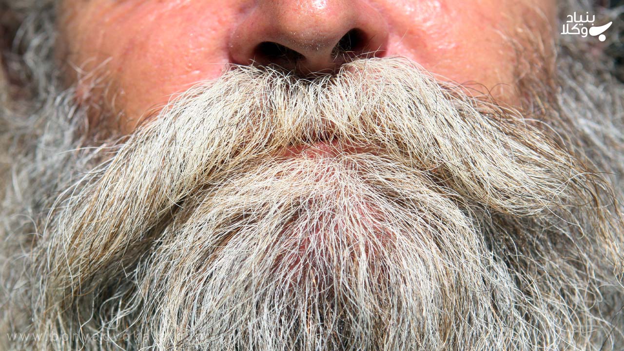 دیه رویش با عیب و نقص ریش
