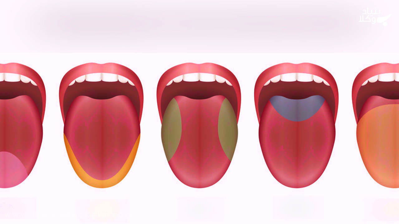 دیه چشایی 2 جرم از بین بردن چشایی
