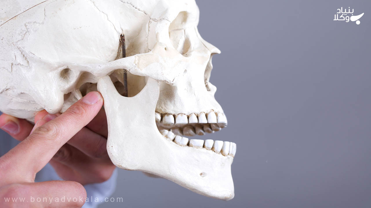 پیگیری پرونده دیه فک با بنیاد وکلا