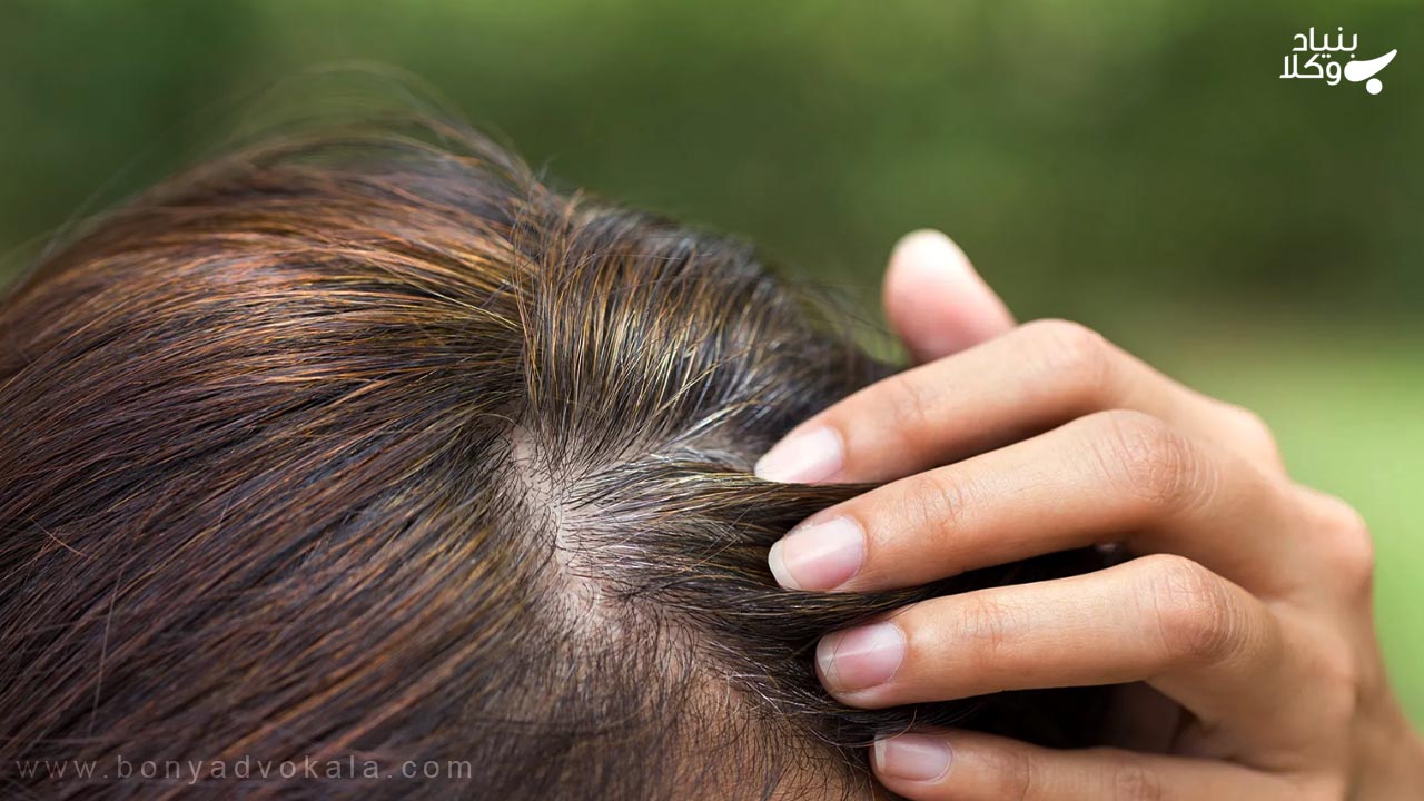 دیه کندن موی سر زن 2 موی سر زن