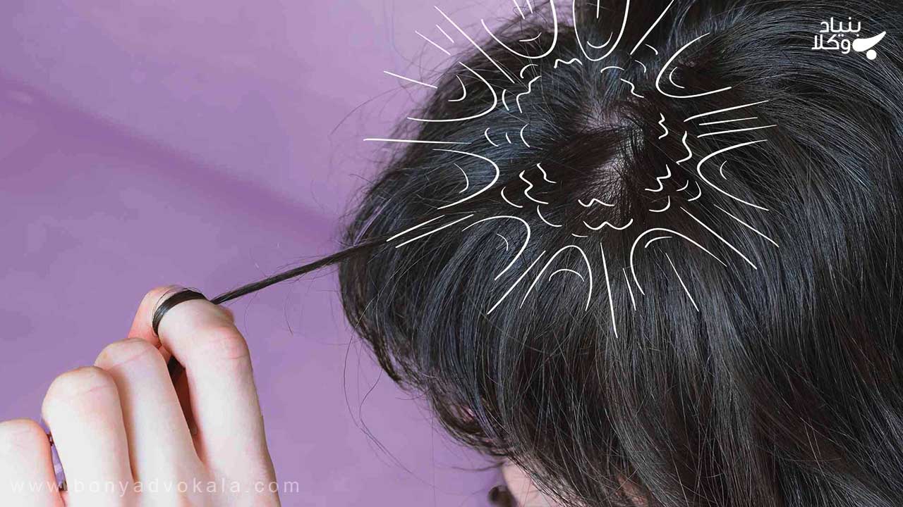 دیه کندن موی سر زن 3 میزان دیه کندن موی سر زن