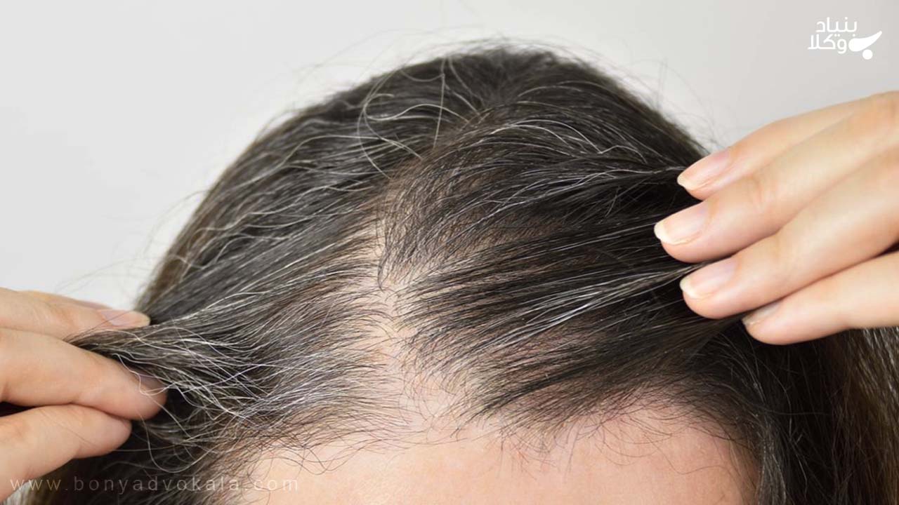 دیه کندن موی سر زن 4 پرداخت دیه کندن موی سر زن