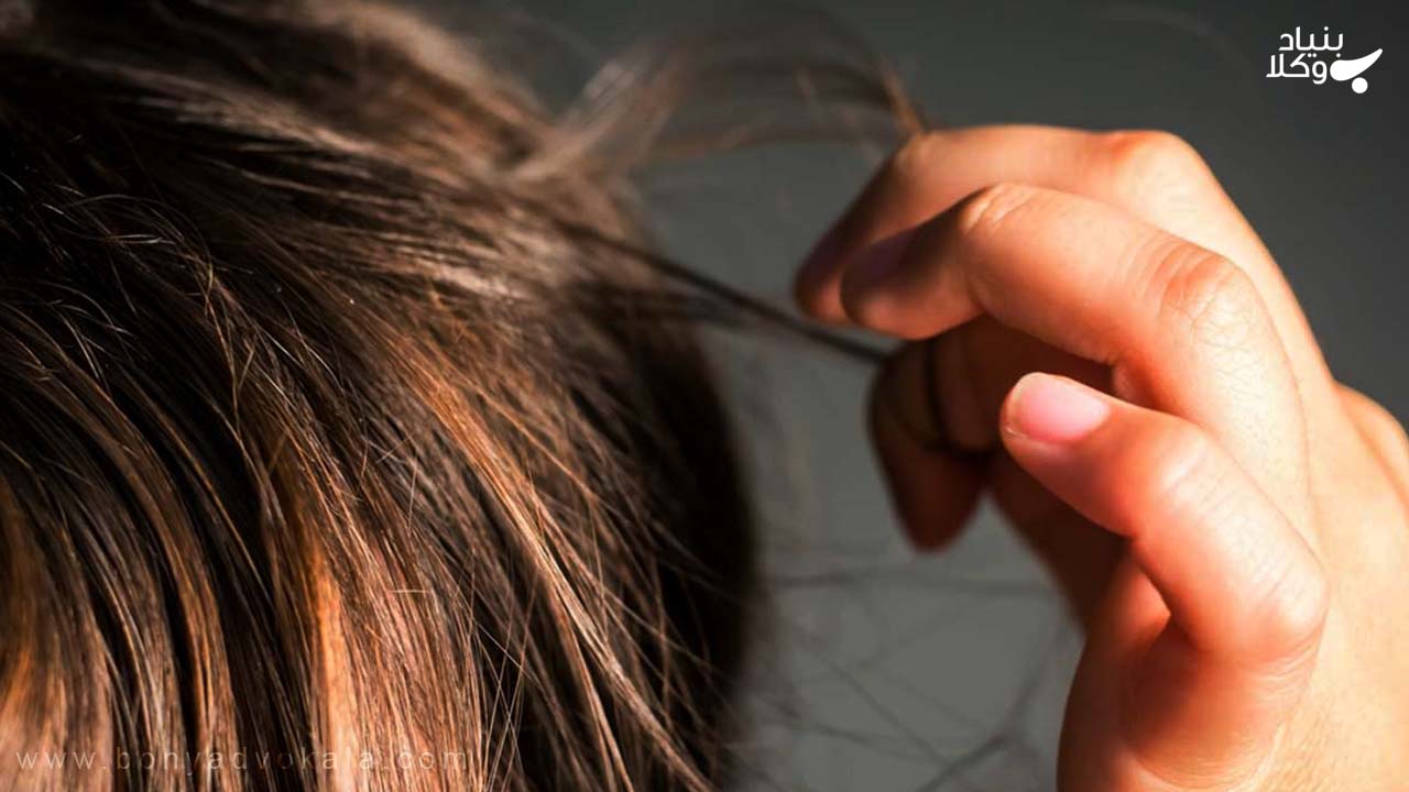 دیه کندن موی سر زن 5 وکیل در دعاوی دیه کندن موی سر زن