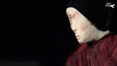 حمایت از بزه دیدگان اسید پاشی و نحوه جبران خسارت ناشی از آن 4 qGkVZN9IZI65G8yRjIUZcro5k9pHDb0uKGCbHL6T