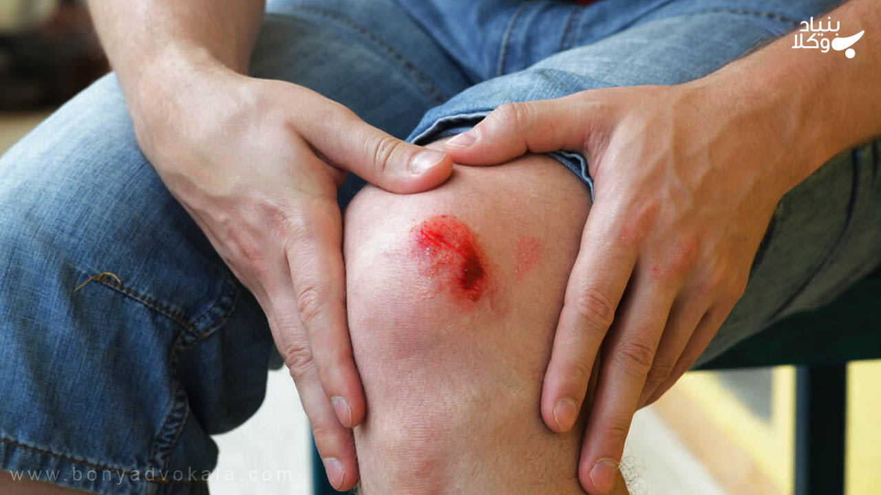 معاینه جنایت نفس