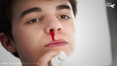 ماهیت و تفاوت خسارت، جریمه، دیه و ارش 18 ceksBVApDuakRUmtcRNS6MhYXNsj64SVixIbnbJz