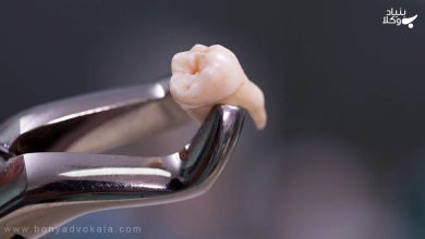 دیه دندان 26 دیه دندان