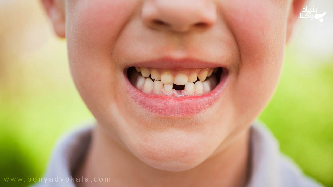 دیه دندان شیری