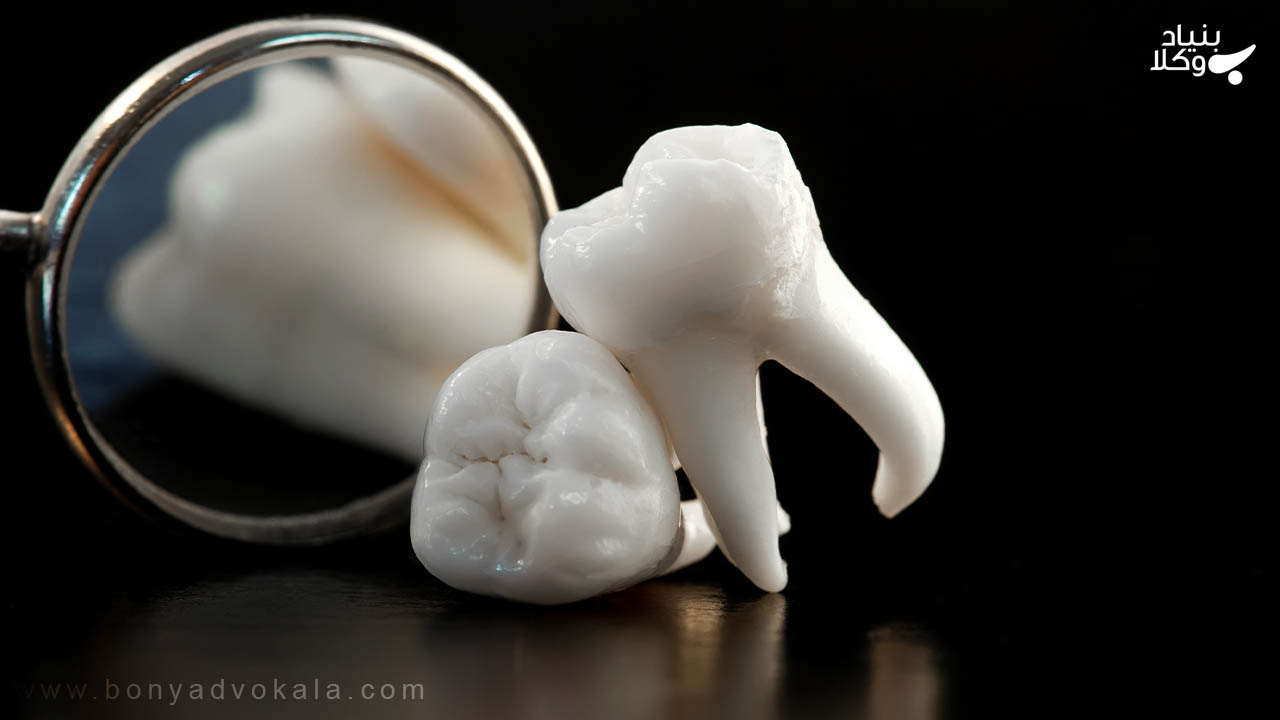 انواع دیه دندان