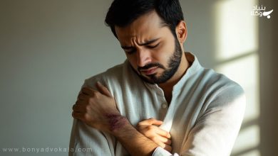 List of types of bruise compensation