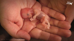 حاملگی و سقط جنین از دیدگاه پزشکی قانونی